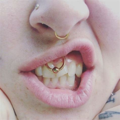 Smiley Piercings: Placement, Aftercare, Risks, and More